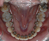 orthodontie paris 20